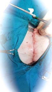 Cirurgia