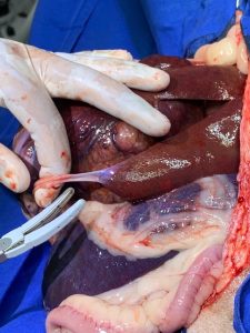 Pormenor-cirurgia